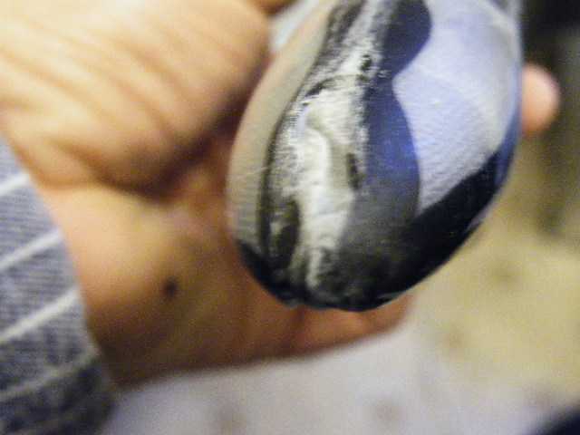 Hier die nicht so gute stelle an der Nase